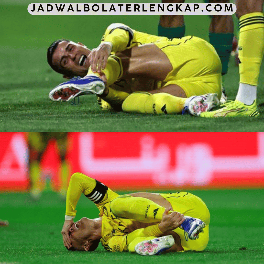 cedera hamstring Cristiano Ronaldo